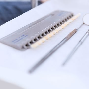 5 Things You Must Know Before Getting Porcelain Veneers
