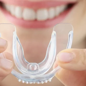 How Do I Choose the Best Mouthguard to Protect My Teeth?