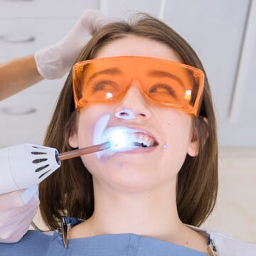 How Long Does Bonding Take to Set? Everything You Need to Know