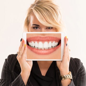 Everything You Need to Know About Teeth Whitening